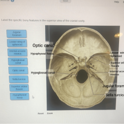 Bony posterior chegg