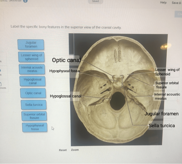 Bony posterior chegg