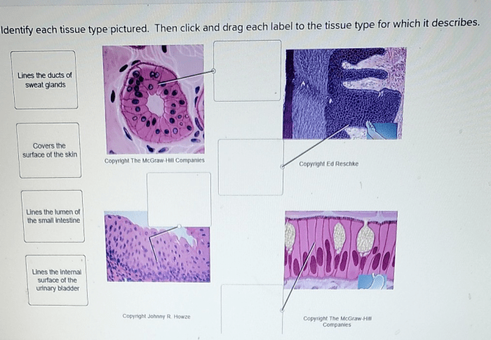 Label the tissues and structures on the histology slide