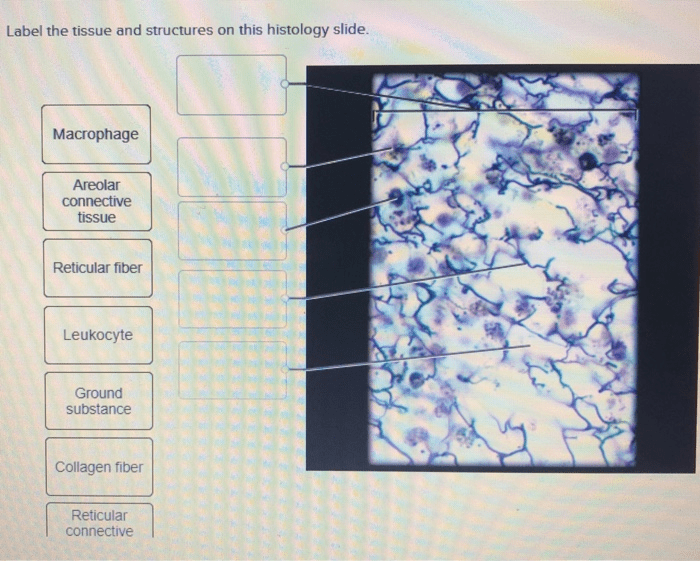 Histology tissue vein artery nerve elastic slides anatomy cs muscle blood vessels skeletal muscular block3 fiber slide arteries veins lymphatic