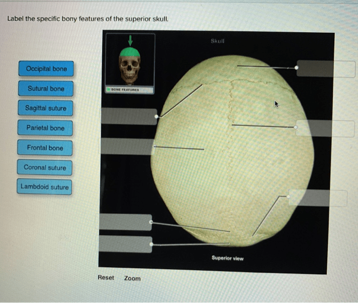 Label the specific bony features of the superior skull