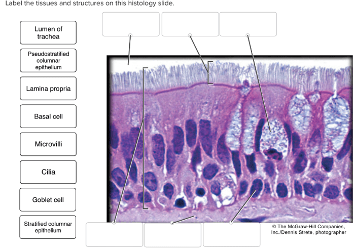 Tissue areolar connective diagram